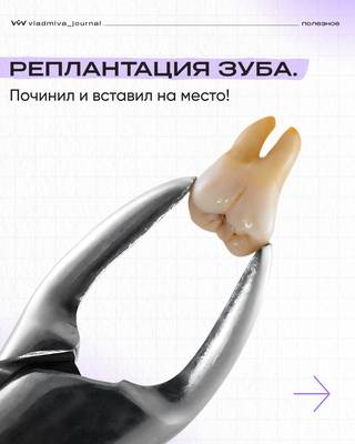 Реплантация зуба: два пути к спасению.